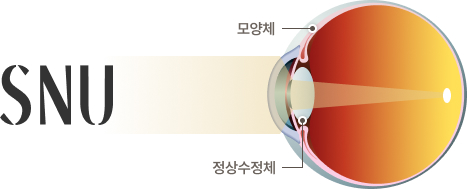 정상안 이미지